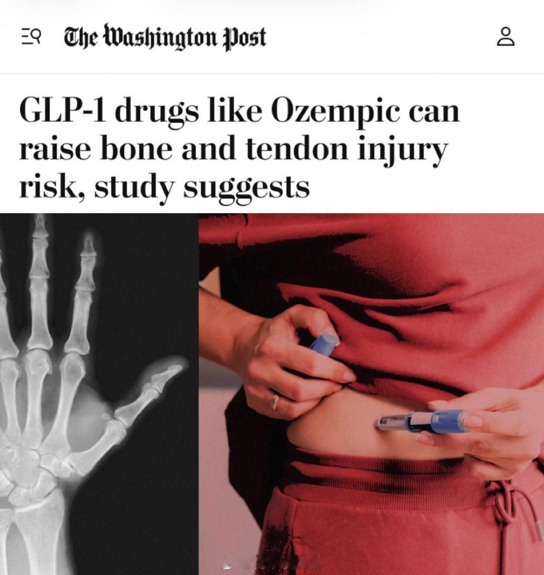 一众谐星的司美格鲁肽脸，将会增加骨骼和肌腱损伤的风险，并可能导致骨质疏松症和痛风