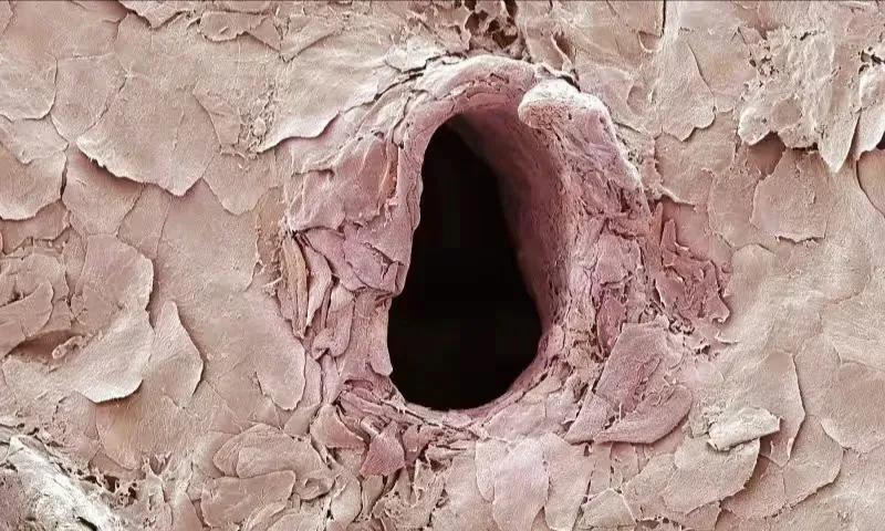 这是什么？
这是一张显微镜下的图片，展示的是打针后留下的微小“针孔”，没想到吧。
