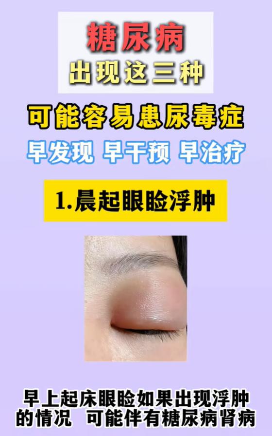 糖尿病人群留意：3 个身体信号，警惕肾脏损伤风险
