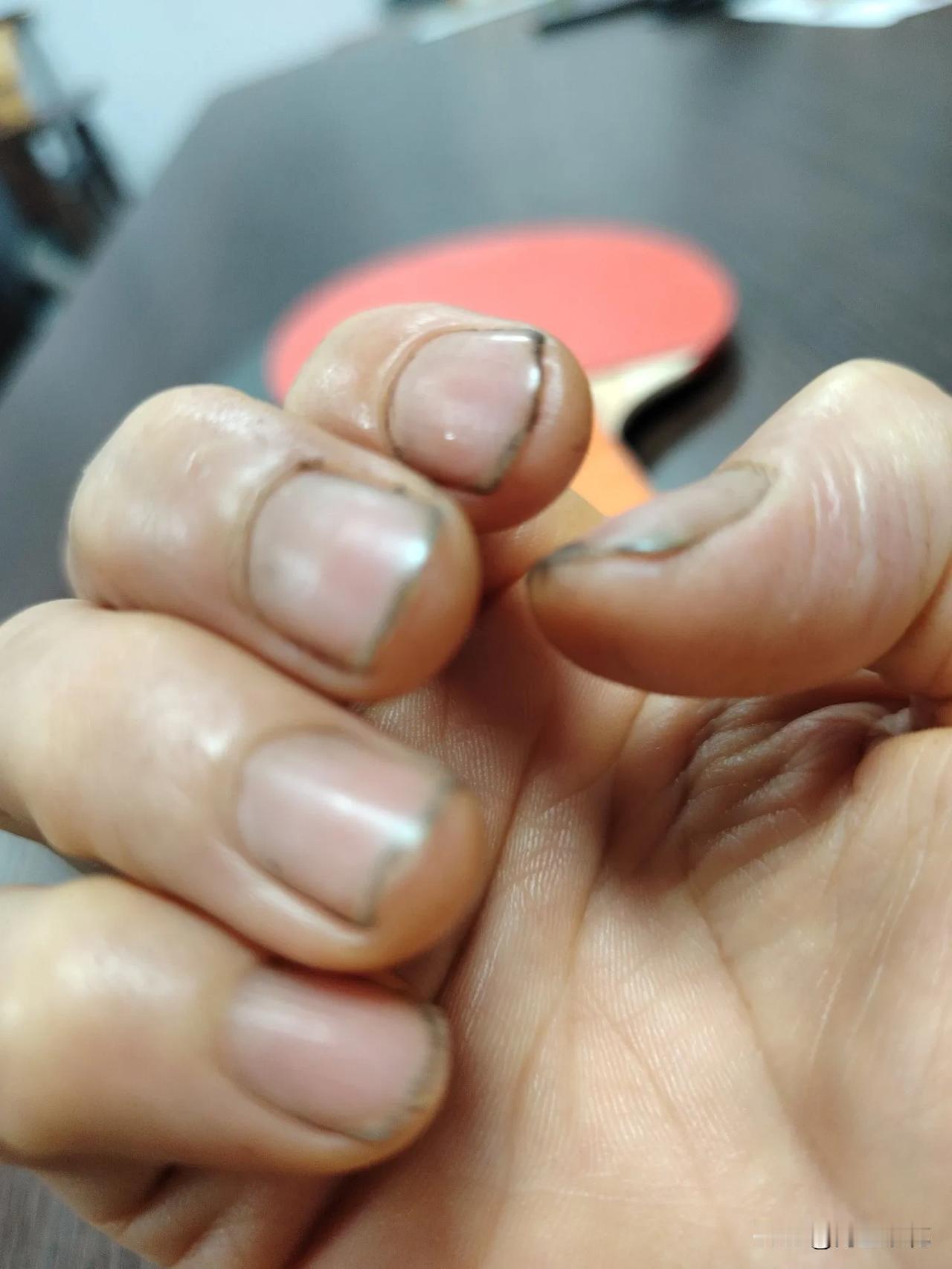 这手可怎么办呢？
洗不掉了。
妈妈是个特别勤快的人，家里家外收拾的整整齐齐干干净