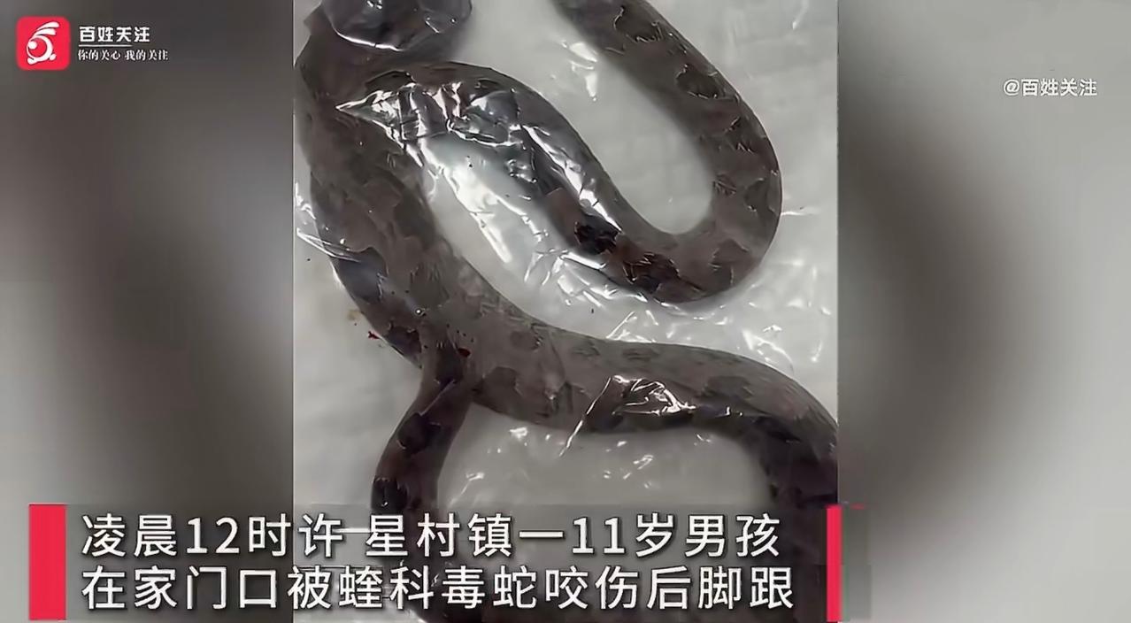 #11岁男孩凌晨如厕踩到毒蛇被咬进ICU##毒蛇#福建南平，一名11岁男孩凌晨出