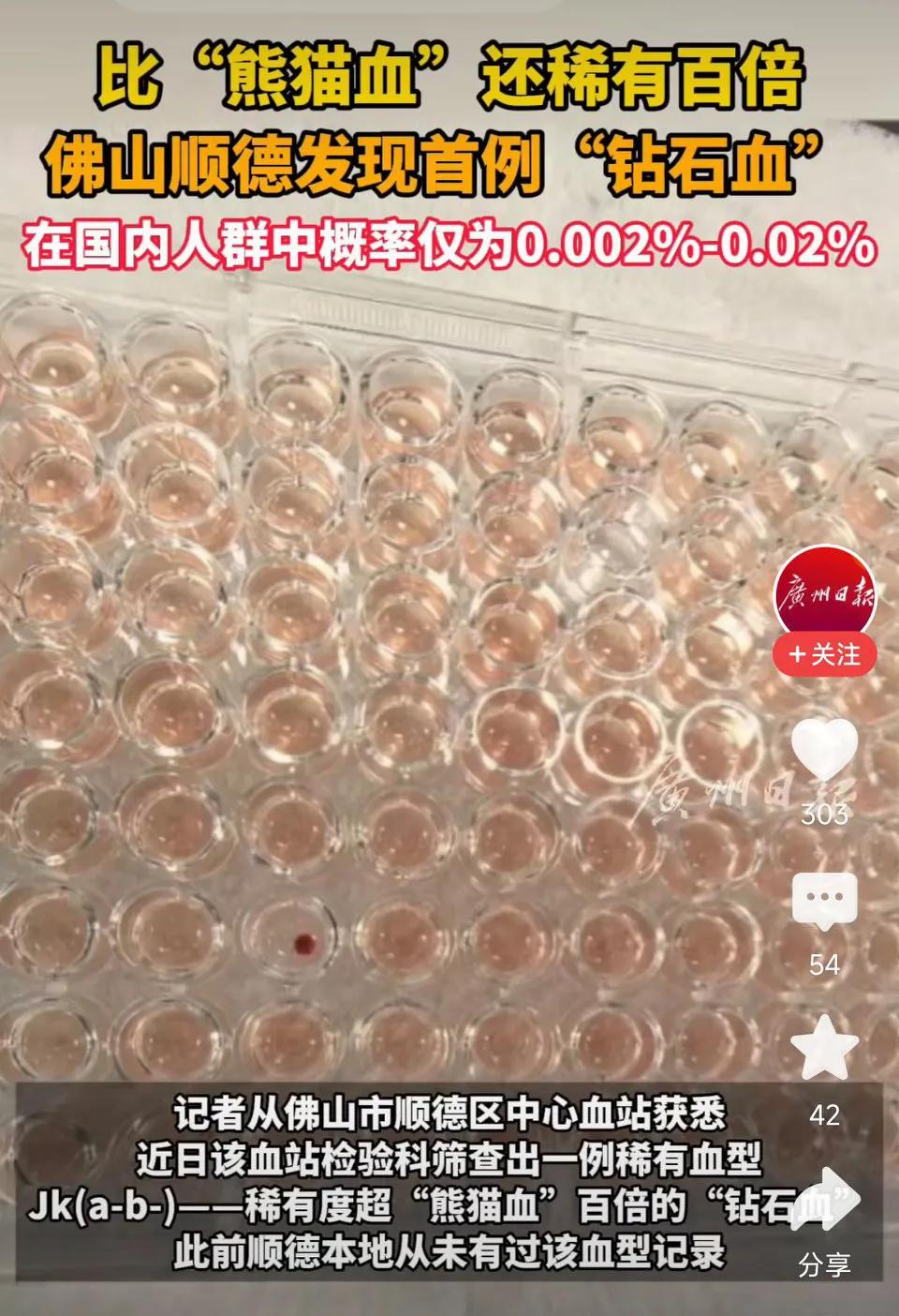 广东顺德发现一例“钻石血”，比“熊猫血”罕见百倍！
佛山市顺德区中心血站检验科筛