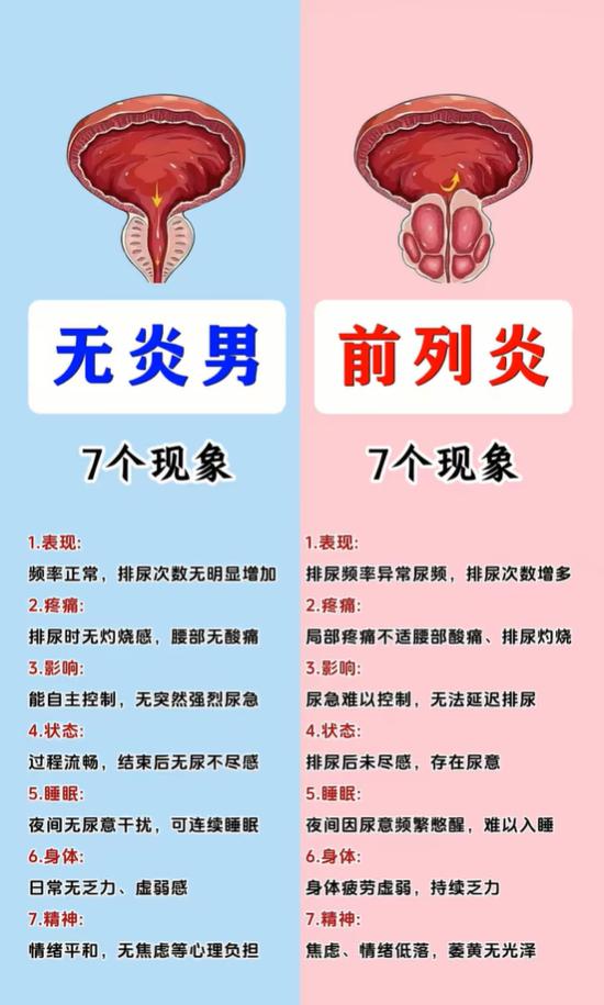 前列腺好不好，看这 7 个表现就知道