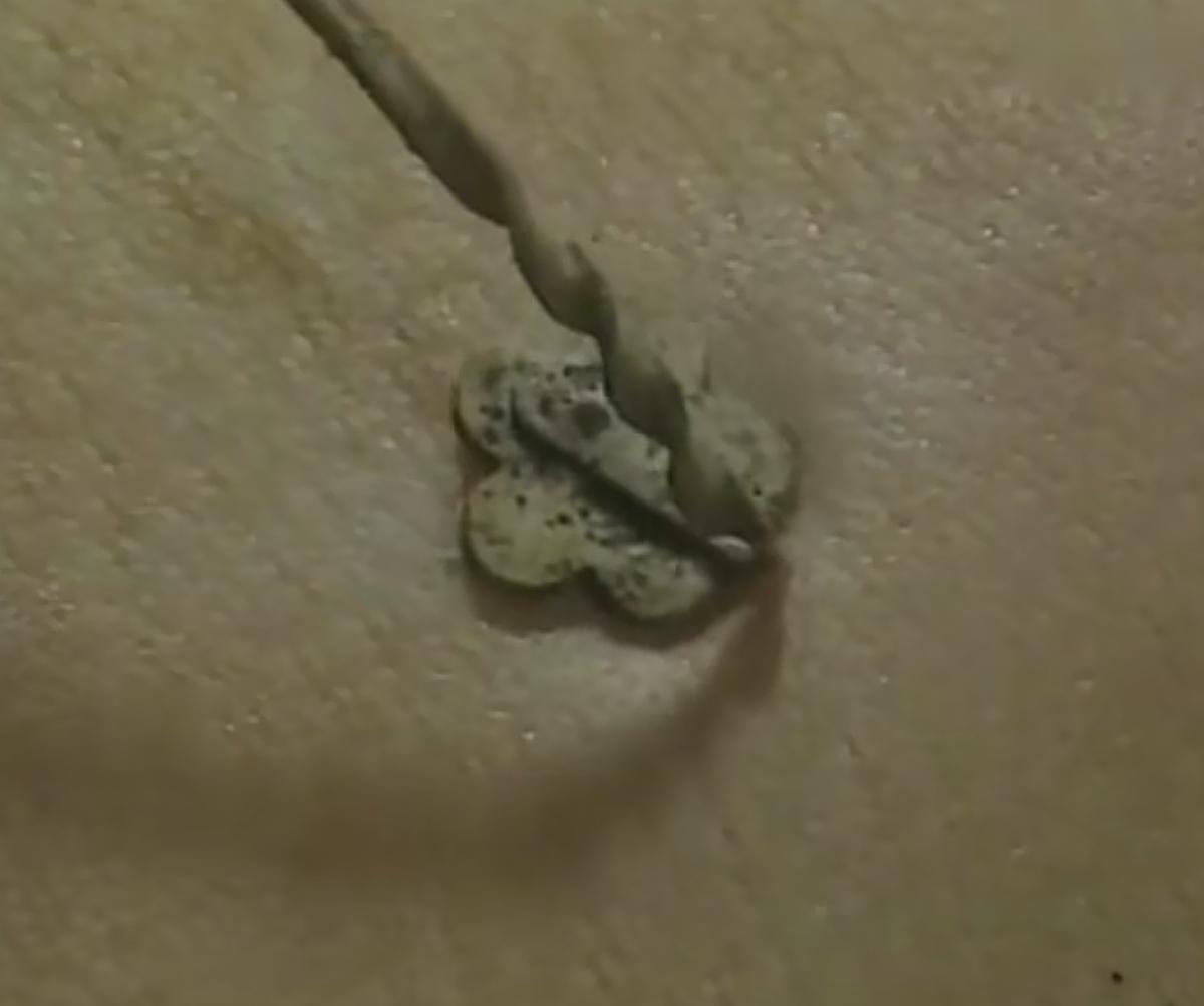 “再续母女缘，但凭梅花烙”
真想不通是什么样的母亲居然狠心到在一个刚出世的小婴儿