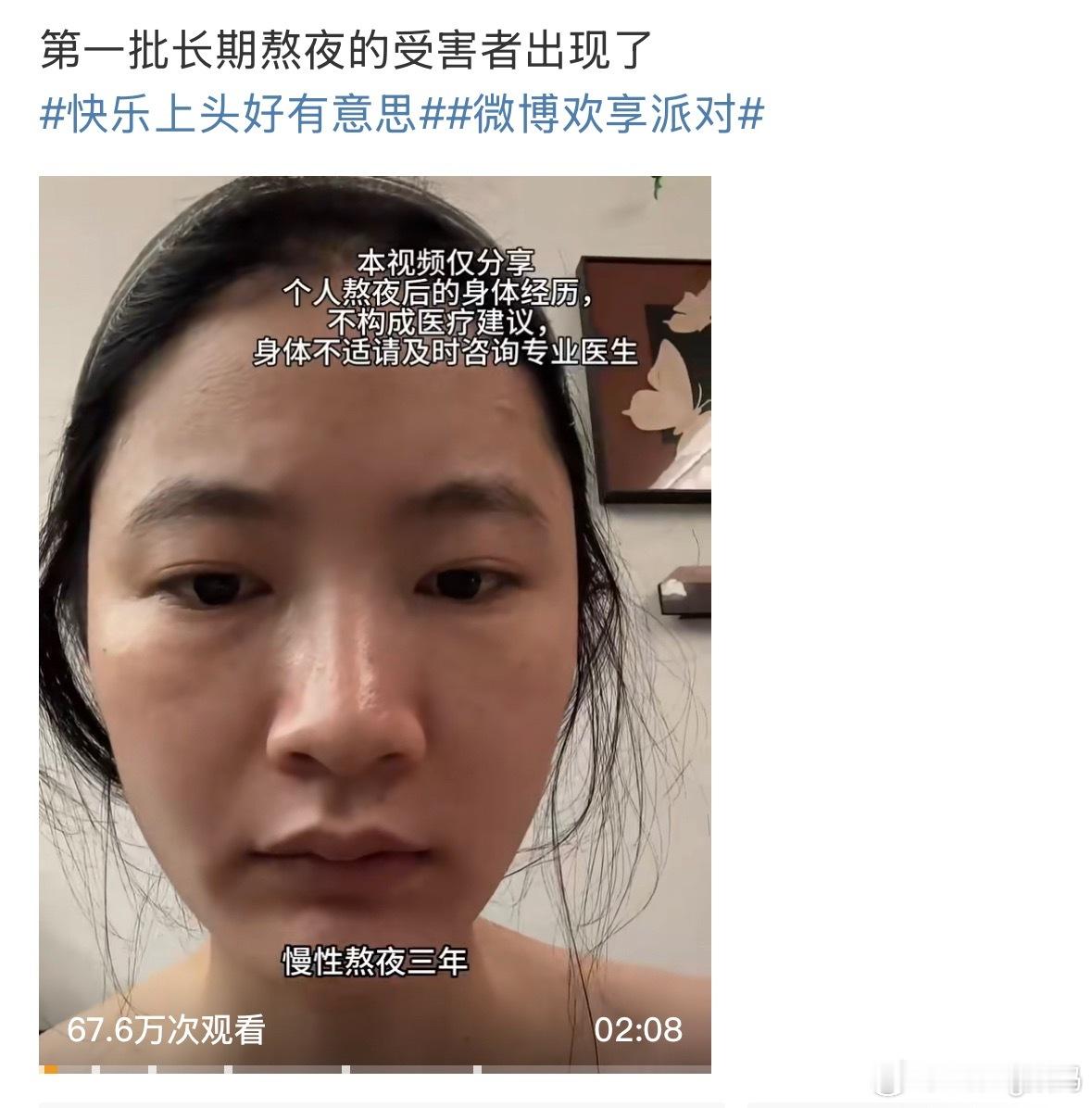 长期熬夜的受害者出现了睡够8个小时的不叫熬夜真正的熬夜是那些一天只睡四五个小时的