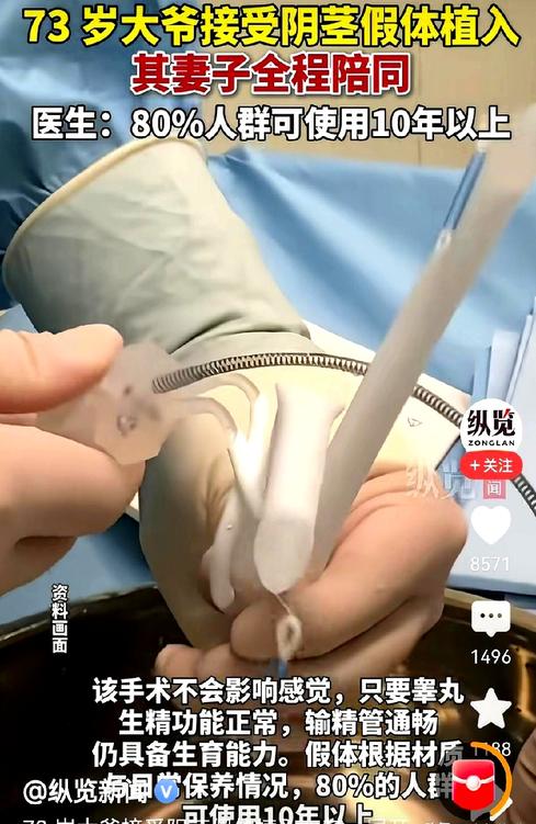 73 岁男子为比自己小 30 多岁的妻子改善夫妻生活，主动接受阴茎假体植入手术，