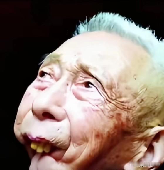 这位英雄在战场上和日本侵略者刺刀见红时，他的下巴被鬼子打掉了，他一辈子只能吃流食