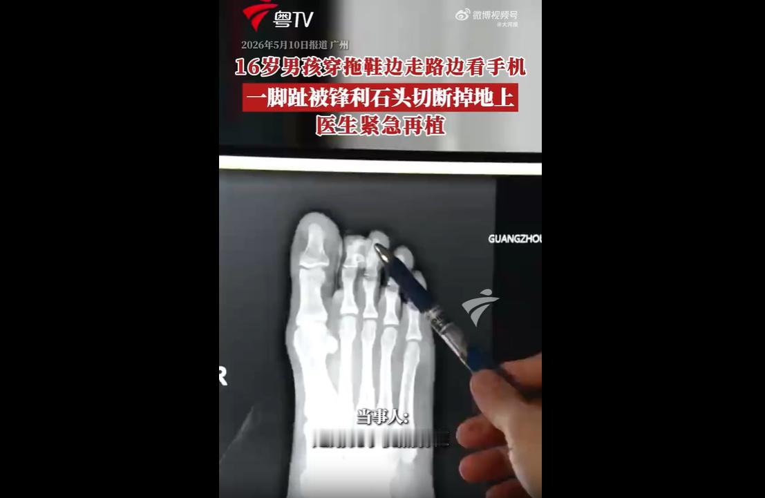 近日，广东一名16岁男生出门时穿着防护性极差的人字拖，走路全程低头看手机，完全忽