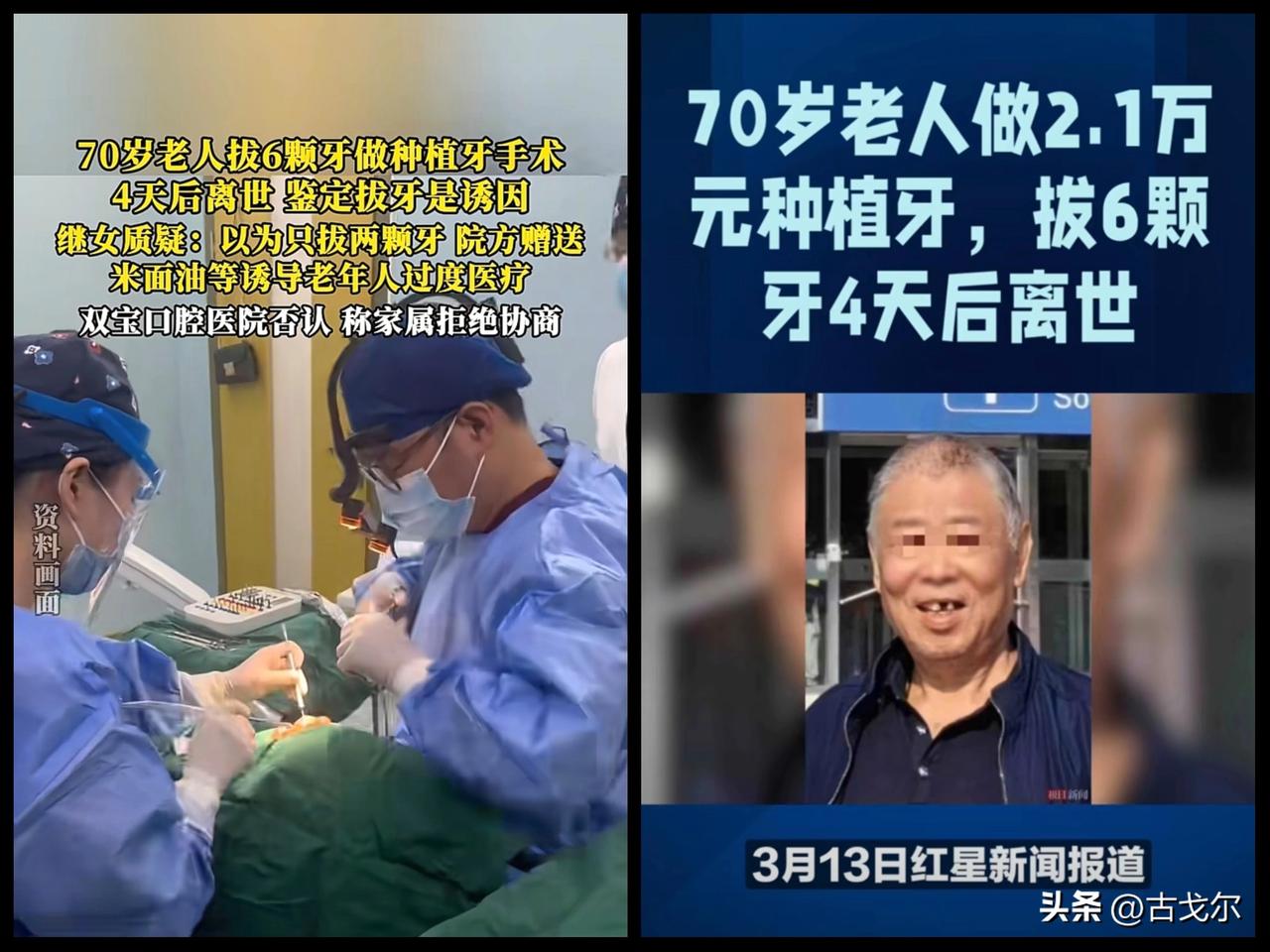 西安双宝医院70 岁种牙老人四天后离世事件，卫健局已立案！更让人愤慨的是医院在老