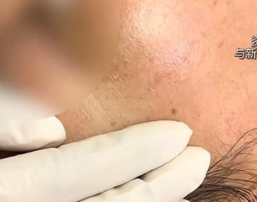 一名女子带着母亲，看到门店推出仅 276 元的淡斑体验套餐，想着价格实惠，就陪着