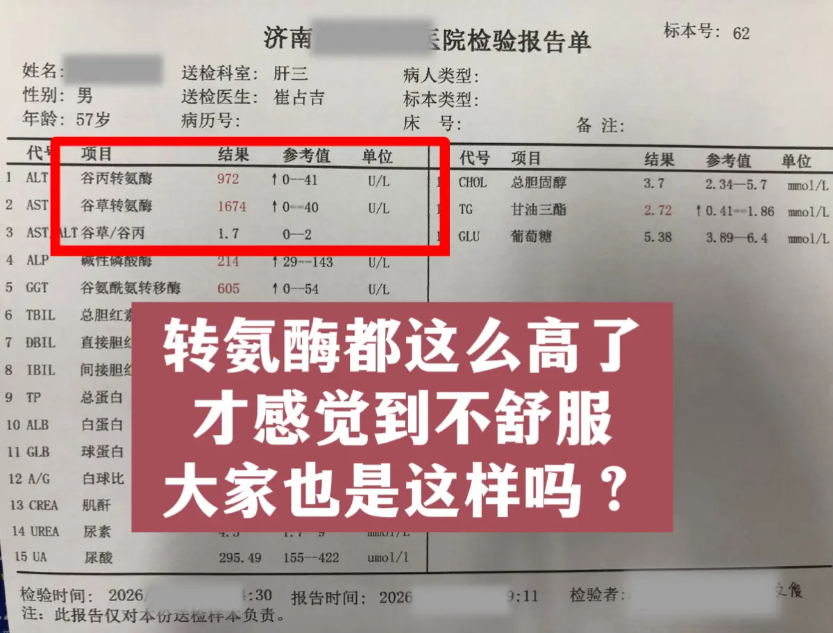 今天门诊来了一位 57 岁的山东患者，说浑身乏力、吃不下饭，一查结果让...