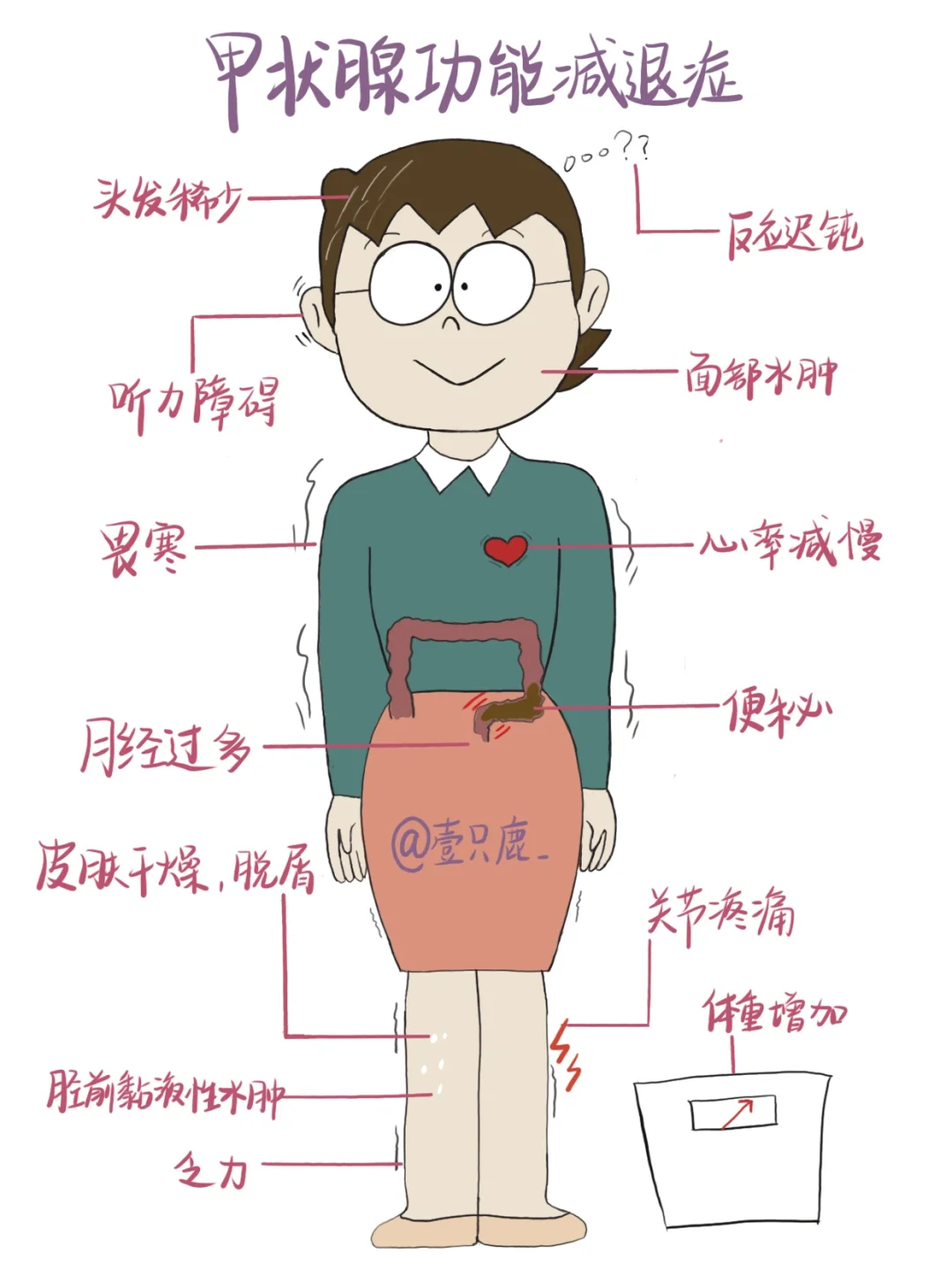 医学生笔记📒｜甲状腺功能减退症🧐