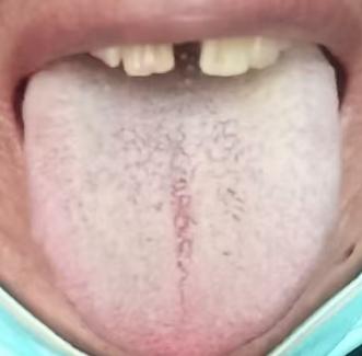 心中欲念深重，海绵体却萎靡不起






为什么明明欲望是非常的重，但是海绵体
