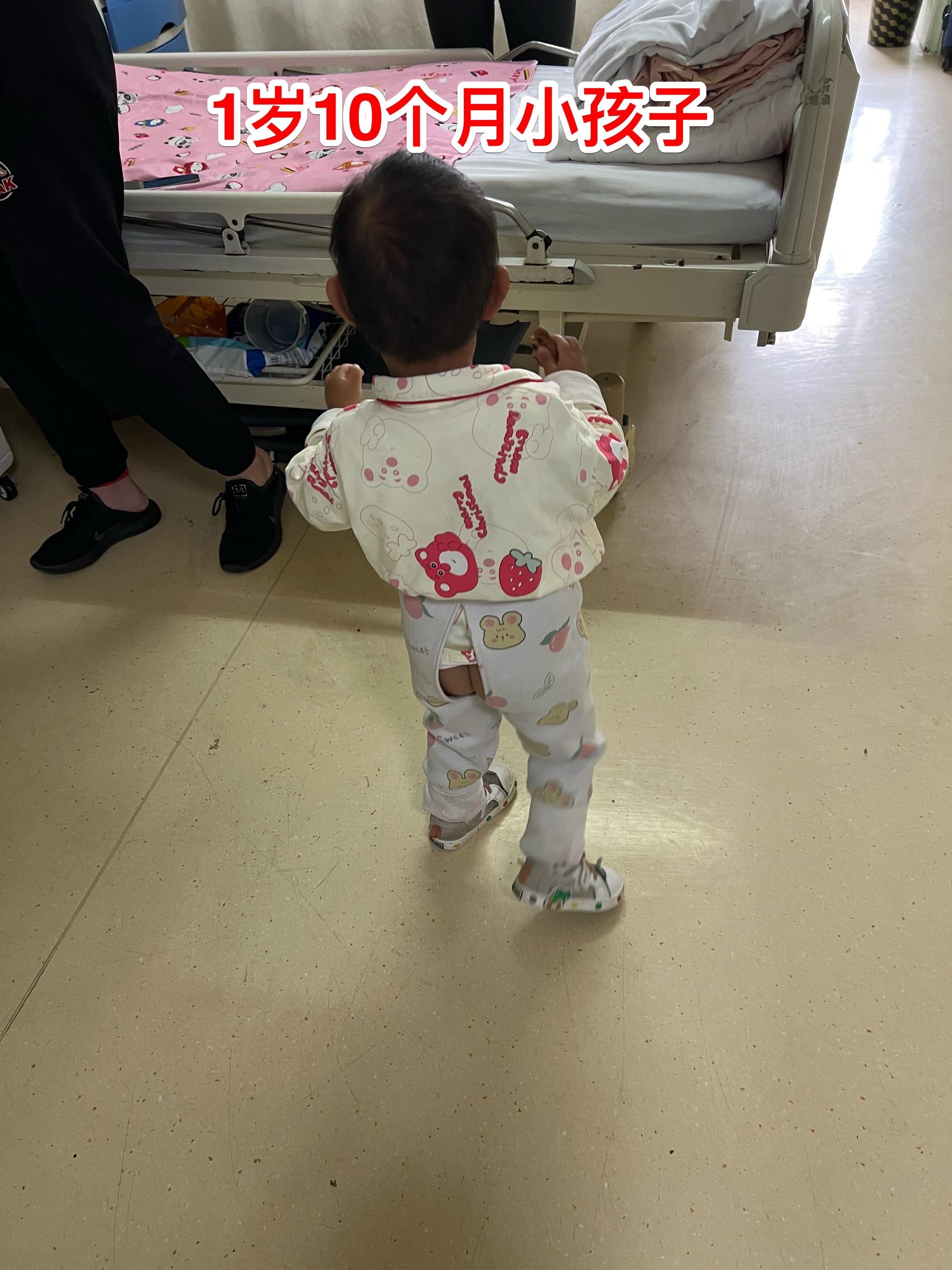 1岁10个月小孩子明天要作手术了。因为视力下降、眼睑下垂发现颅咽管瘤。...