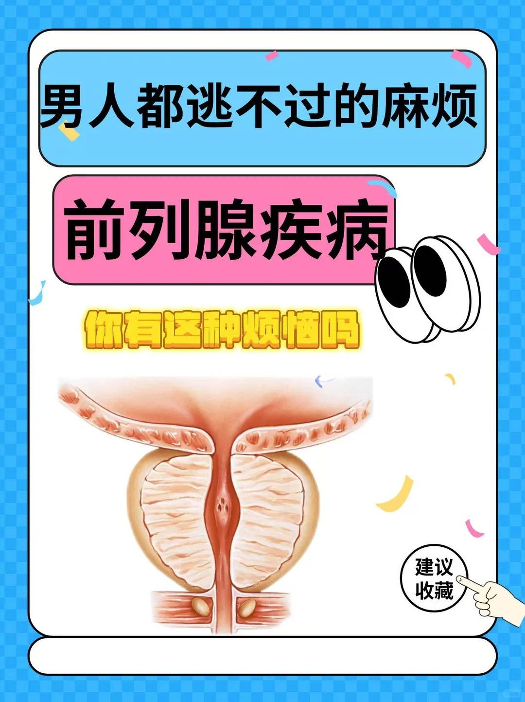 男性高发的前列腺问题，很多人都中招了