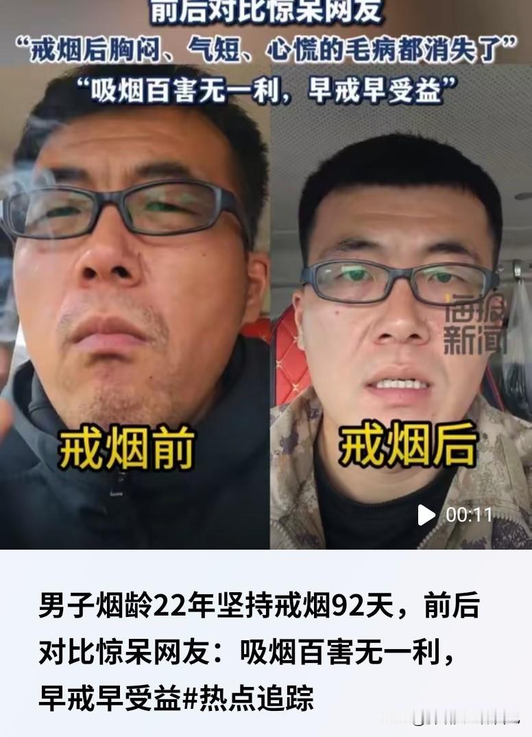 咱榆林人快看！烟龄22年戒烟92天，前后变化堪比换张脸！
 
家人们谁懂啊！烟龄