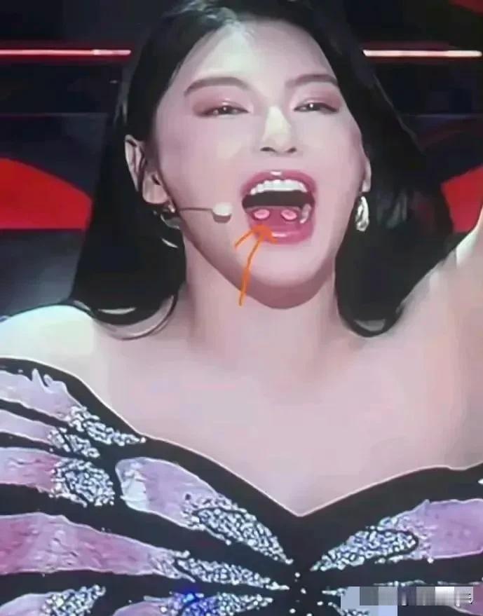 妈呀！
张雨绮舌头上两片圆圆的东西是什么？
看着怪突兀的，细看又怪可爱的，
嘴里