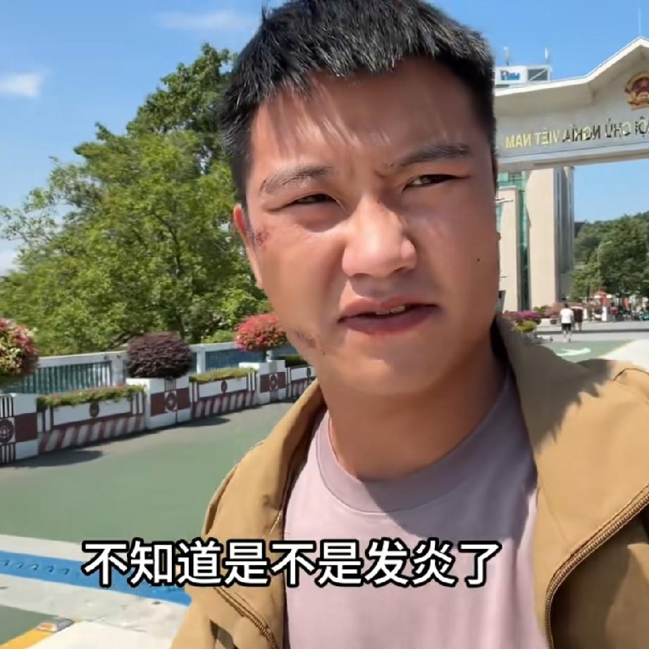 小潘，这张脸大家都以为被小树给打了，因为他断更了，给小树继续盖房子，跟小叔小婶的