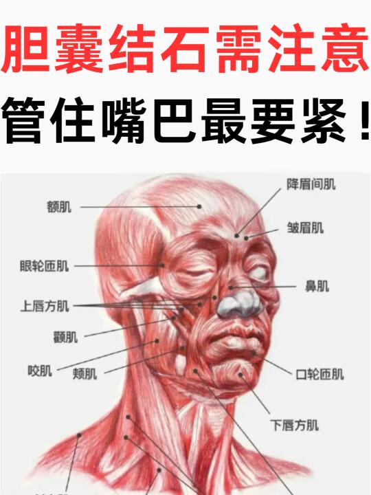 胆囊结石需注意，管住嘴巴最要紧！