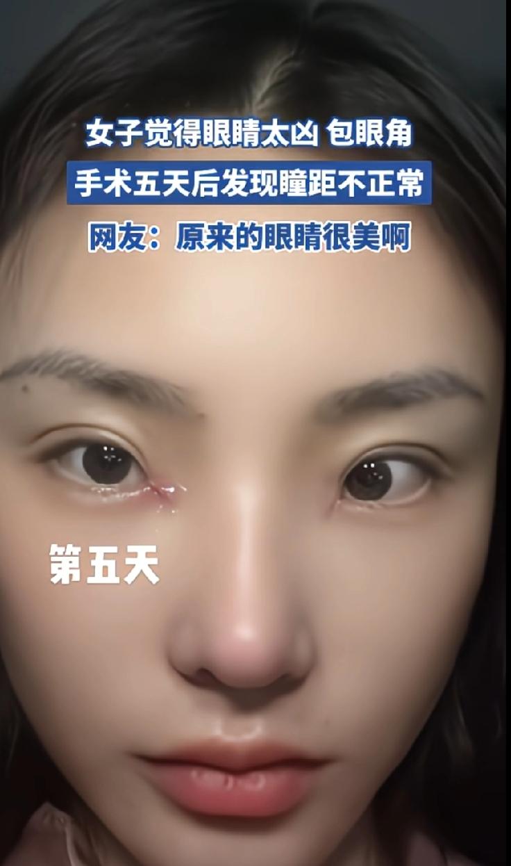 见过整容为了变美的，没见过 整容为了把自己整丑的。

一女子分享自己因为觉得自己