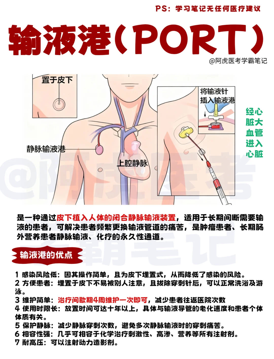 医学生笔记📒：输液港（PORT）👆