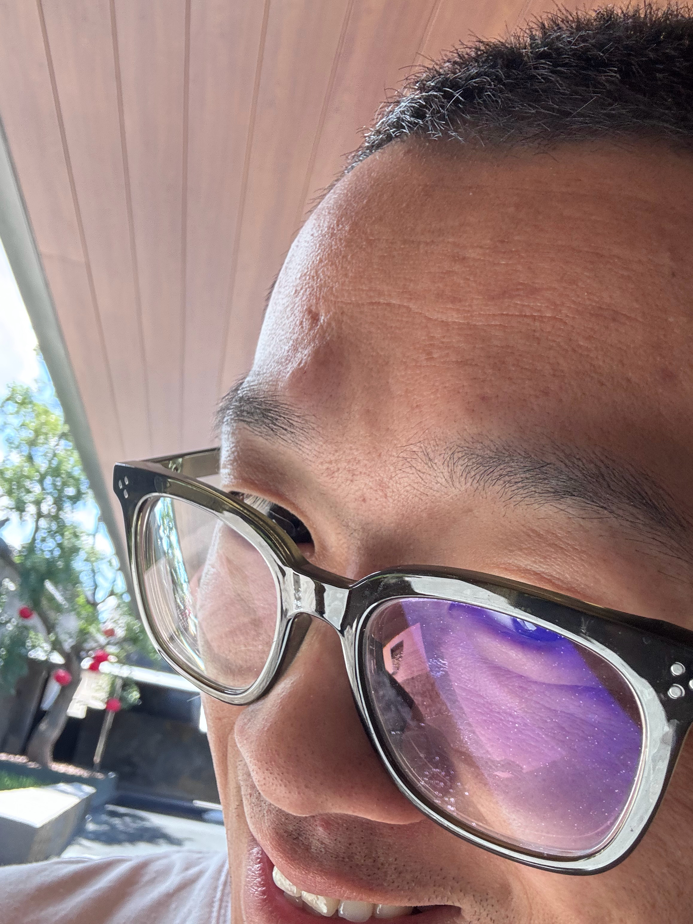 我又毁容了 又干车门框上了 大同