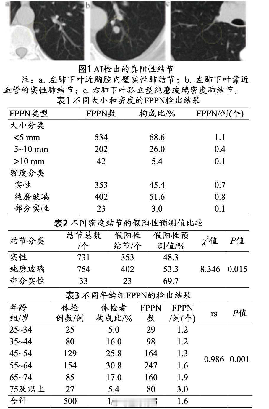 一个小知识，现在有不少肺结节，不一定是医生发现的，而是AI发现的。这是我两年前写