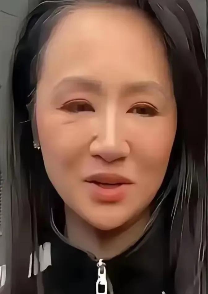 ​​曹颖甲状腺癌术后第7天
她挂着引流管开播
我一点也不觉得她辛苦，一点也不心疼