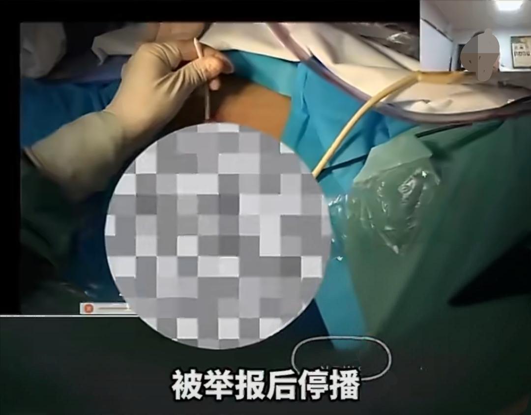 惊掉下巴！手术室架摄像头直播，女患者隐私被暴露在5万人眼前。
 
大家敢信吗？手