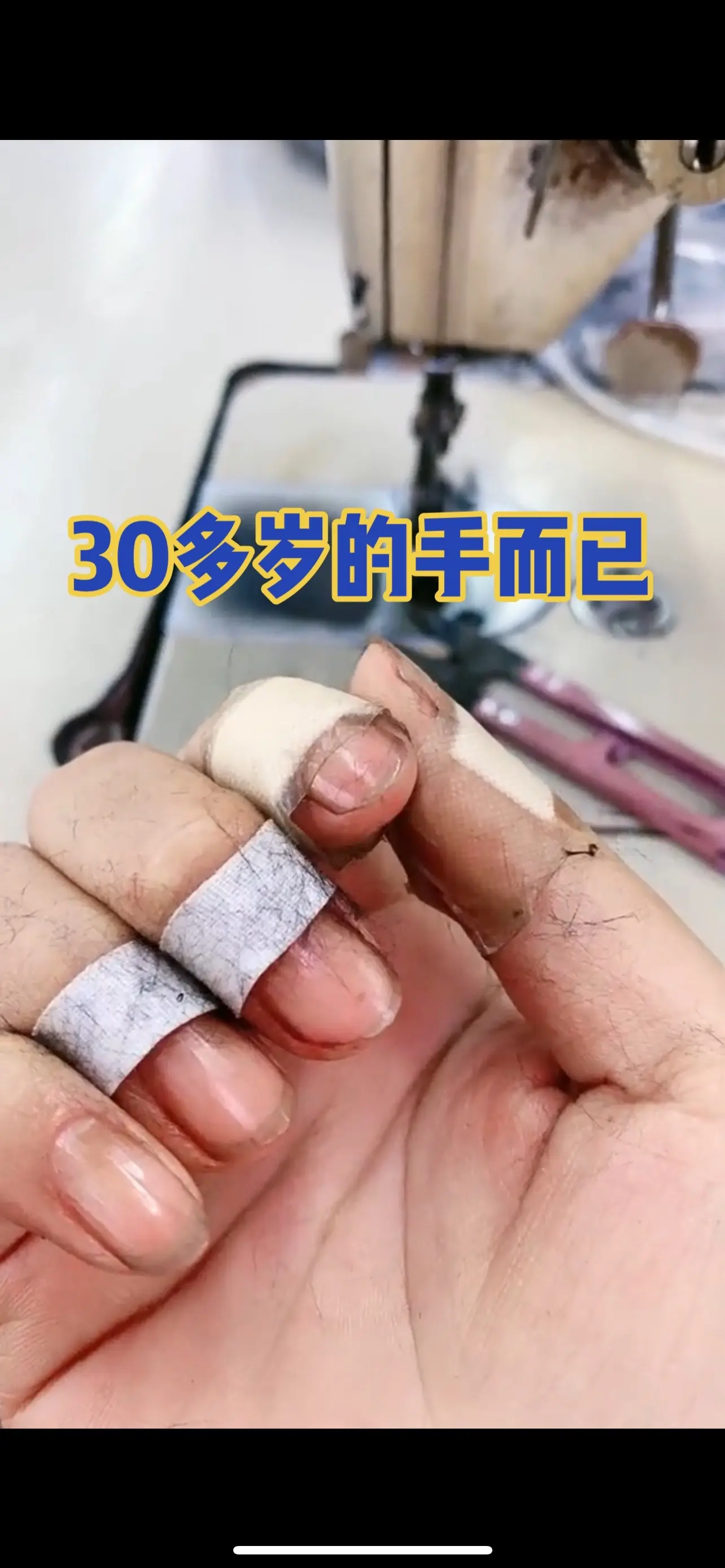 我可以看看你们的手吗？我的手好痛啊😭😭😭