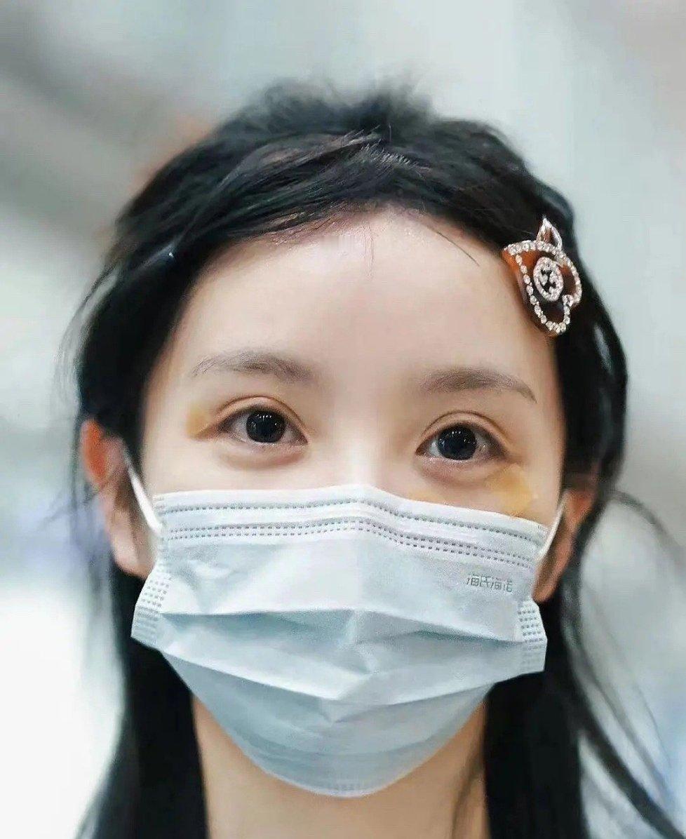 田曦薇素颜怎么看起来有点肿？ ​​​