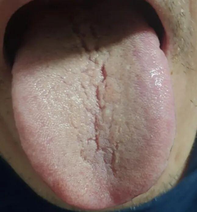 “气血为纲，清热为辅”：治疗湿热的正确之道
让我重申一点，在清除湿热之前，我们必