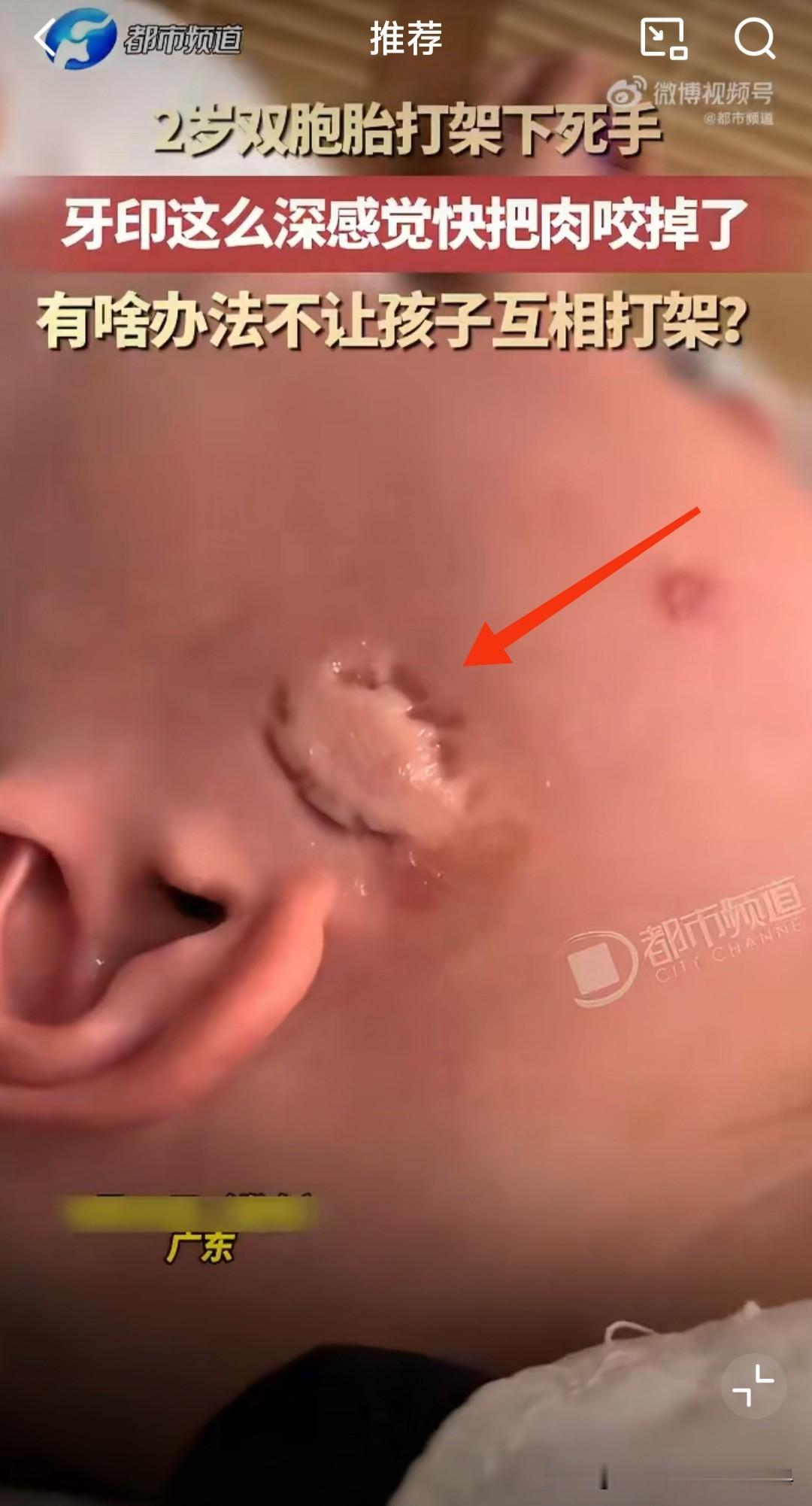 人类幼崽的战斗力有多强[捂脸]！一对2岁双胞胎，大人稍不注意，他俩又打起来了。等