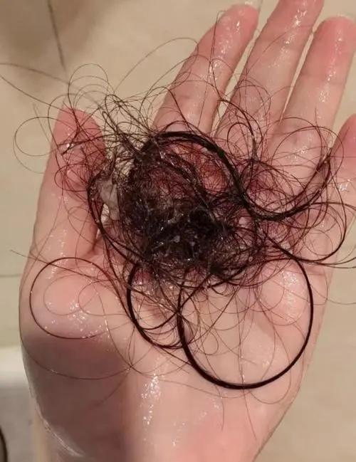 冬天容易掉发，别慌？用好这四味药，补足肾气，强韧发根

在中医理论中，肾主掌人体