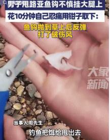 是个狠人！9月17日江西抚州，一男子去河边钓鱼，抛竿时鱼钩被后面的草挡住了，结果