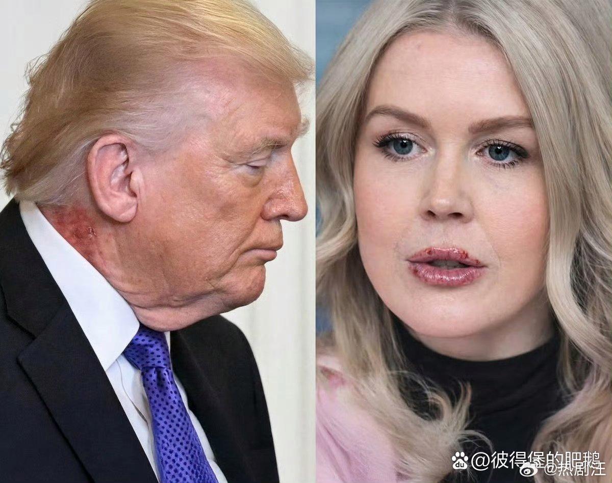 白宫发言人莱维特的嘴这是肿么了？我好像发现了美国白宫里面一些惊人的事情。 