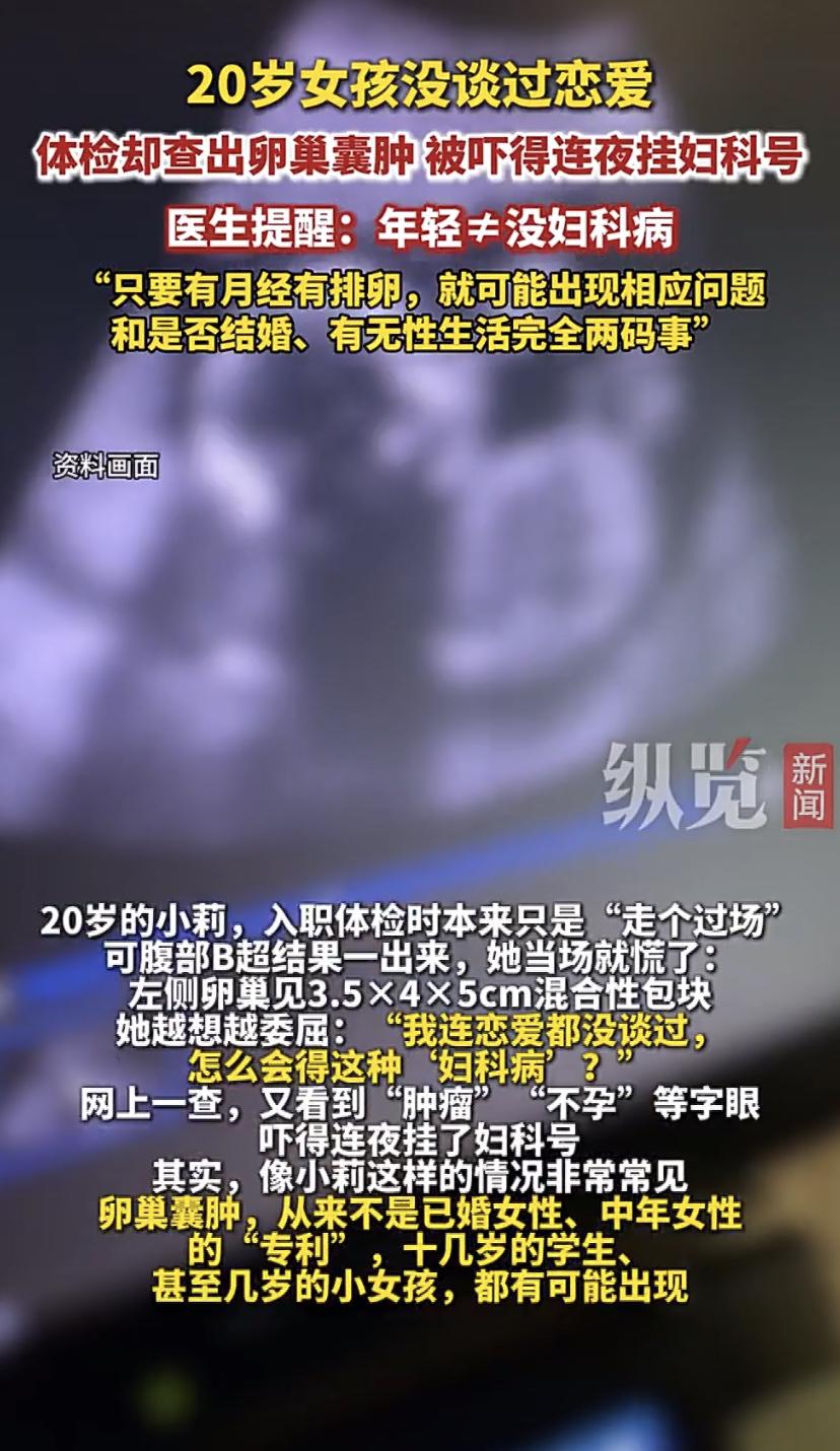 20岁女孩没谈过恋爱，体检查出卵巢囊肿!医生一番话让她懵了
河北邯郸20岁姑娘小
