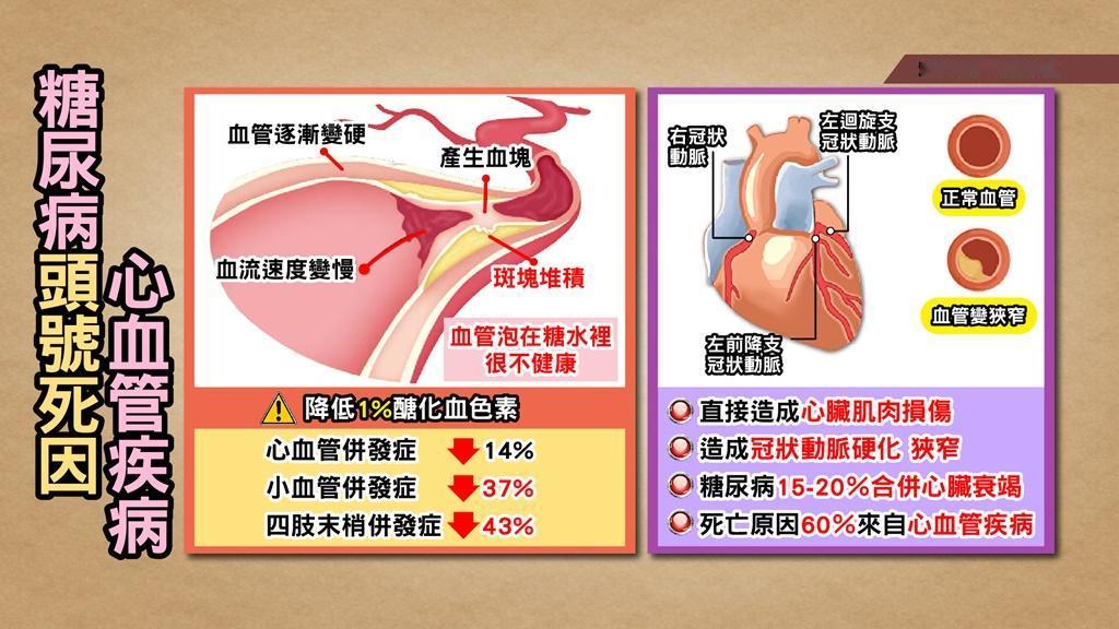 ST 段抬高。
ST 段抬高是急性心肌梗塞的一种表现，代表着心脏上的冠状动脉出现