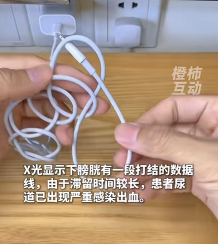 “丢人丢大了！”6月23日报道，广东，一男子因为好奇，把一根25厘米长的数据线塞