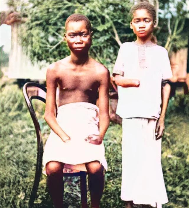 1885年，非洲刚果，两名土著居民，被殖民者残忍地砍下了手掌，而他们被惩罚的原因