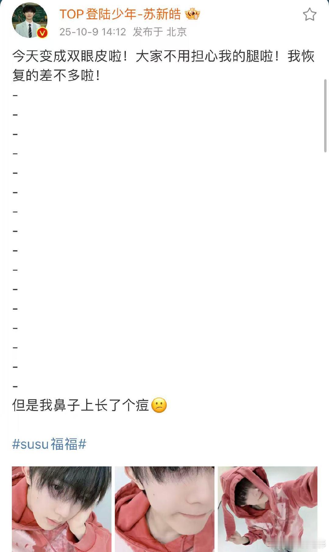 苏新皓让大家不用担心了苏新皓称腿恢复的差不多了苏新皓让大家不用担心了！ 苏新皓发