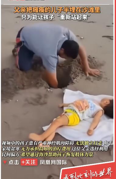 没钱做康复，哥伦比亚父亲把残疾儿子埋进沙子里，在海边练站！

哥伦比亚一处海边沙