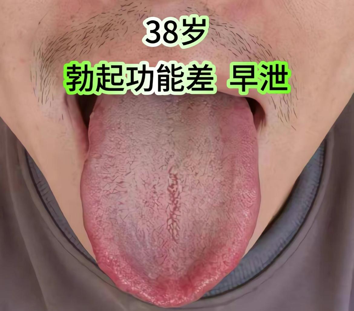 你别说38岁了，像这个舌象，你说18岁我也信[擦汗]
欲望可太大了，一把年纪了还