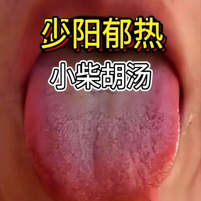 门诊看了四十多年，天天听男患者抱怨一句话：“大夫，我补肾补到流鼻血，怎么还是软得