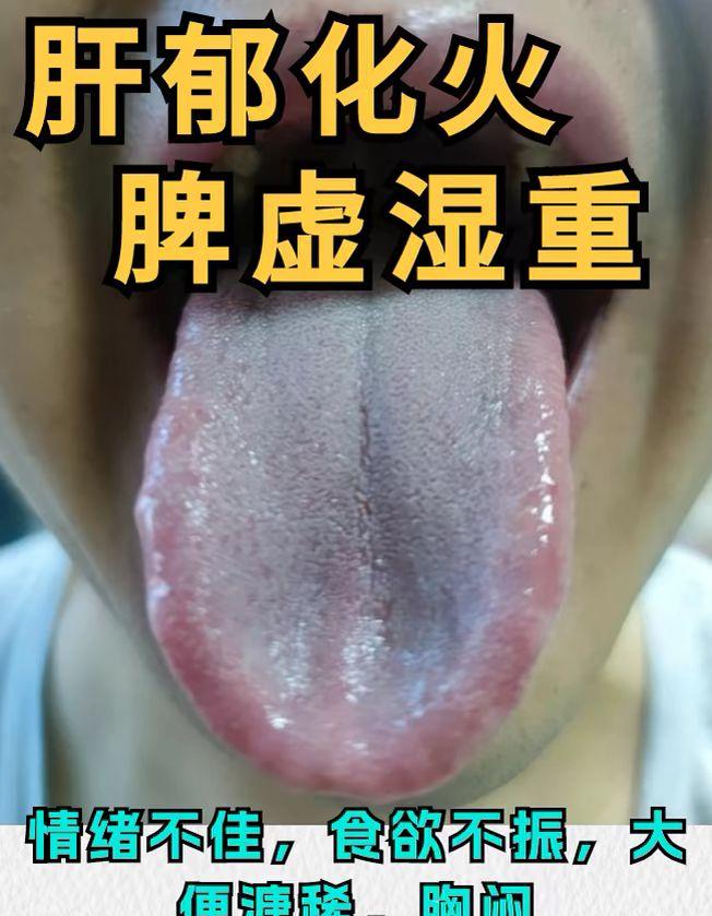 正在看诊中 不同舌苔对应不同症状 看看你是那种