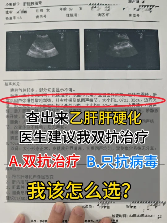 我一直就有乙肝，但也没啥症状，就没吃抗病毒药，也没当回事。 这两天觉得...