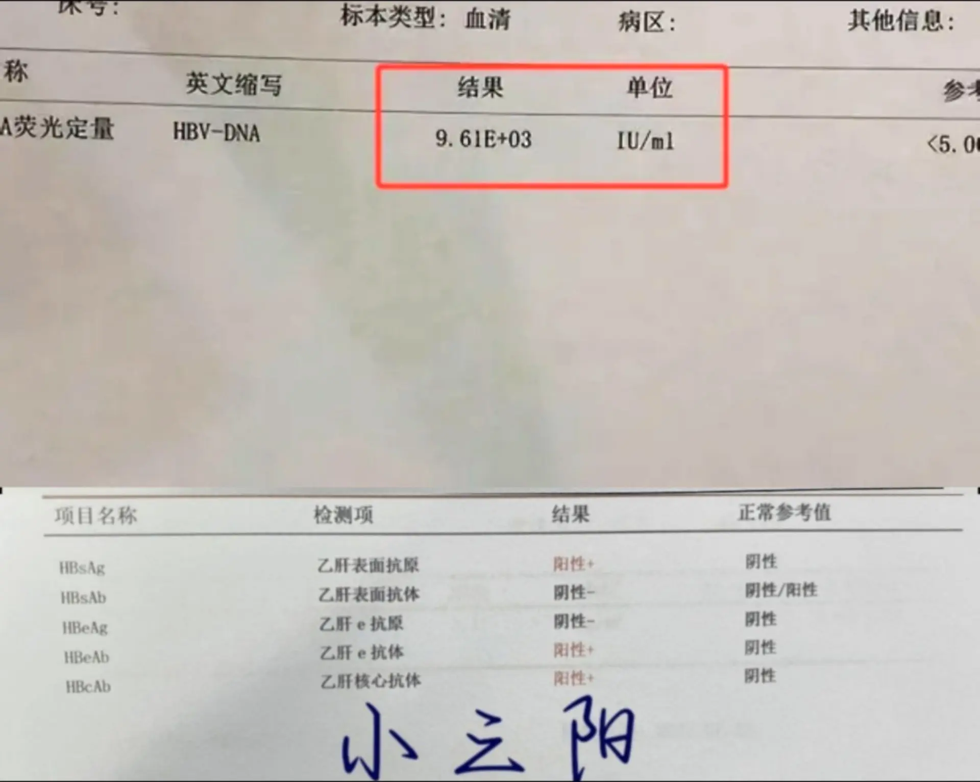 淄博网友咨询：乙肝肝功转氨酶都正常，肝弹12.3，就病毒量是9.61e...
