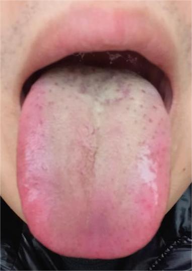 肝郁为什么会导致下焦湿热，甚至引发前列腺问题？中医：郁久必热！

最近经常翻看各
