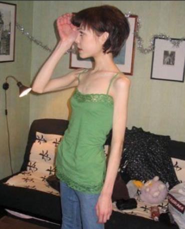 河南一90后女子为减肥辟谷，半个月不吃饭、只喝水，一个月瘦了40斤，代价是什么？
