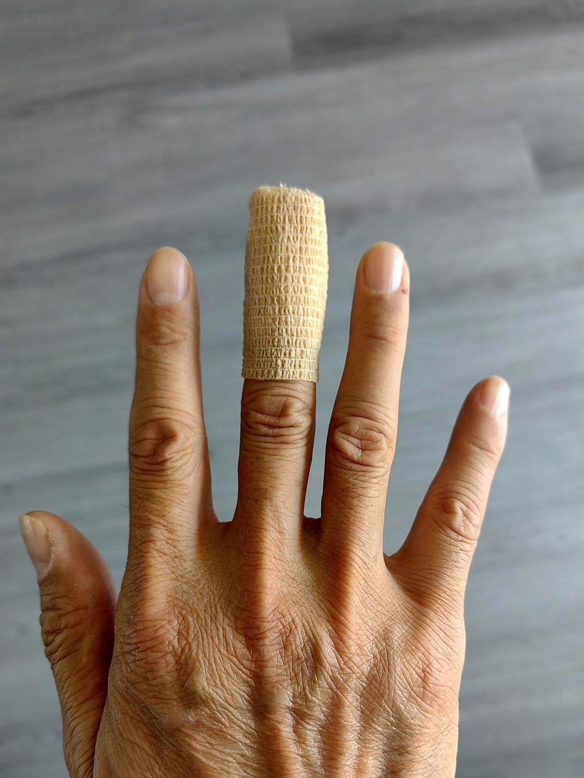 我捂着往外冒血的指头，一头冲进楼下诊所。
想着几块钱，换个药，包一下就完事。
护